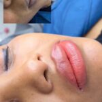 Nahaufnahme eines Lip-Blush Ergebnisses: vollere Farbwirkung und sauber definierte Lippenkontur