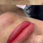 Vorher-nachher Lippen: nach der Pigmentierung wirkt die Farbe frischer und gleichmäßiger