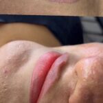 Lippen Vorher-Nachher: gleichmäßige Lip-Blush Pigmentierung mit natürlichem Farbverlauf