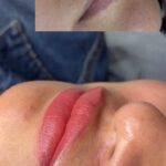 Lippen Vorher-Nachher: gleichmäßige Lip-Blush Pigmentierung mit natürlichem Farbverlauf