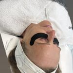 Kundin während einer Power-Peel Behandlung, Textoverlay „Power peel“ im Bild sichtbar